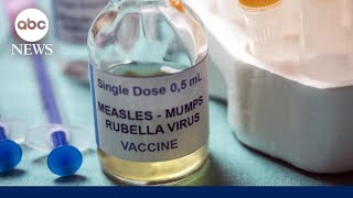 Answers to top measles questions about vaccines, immunity and symptoms