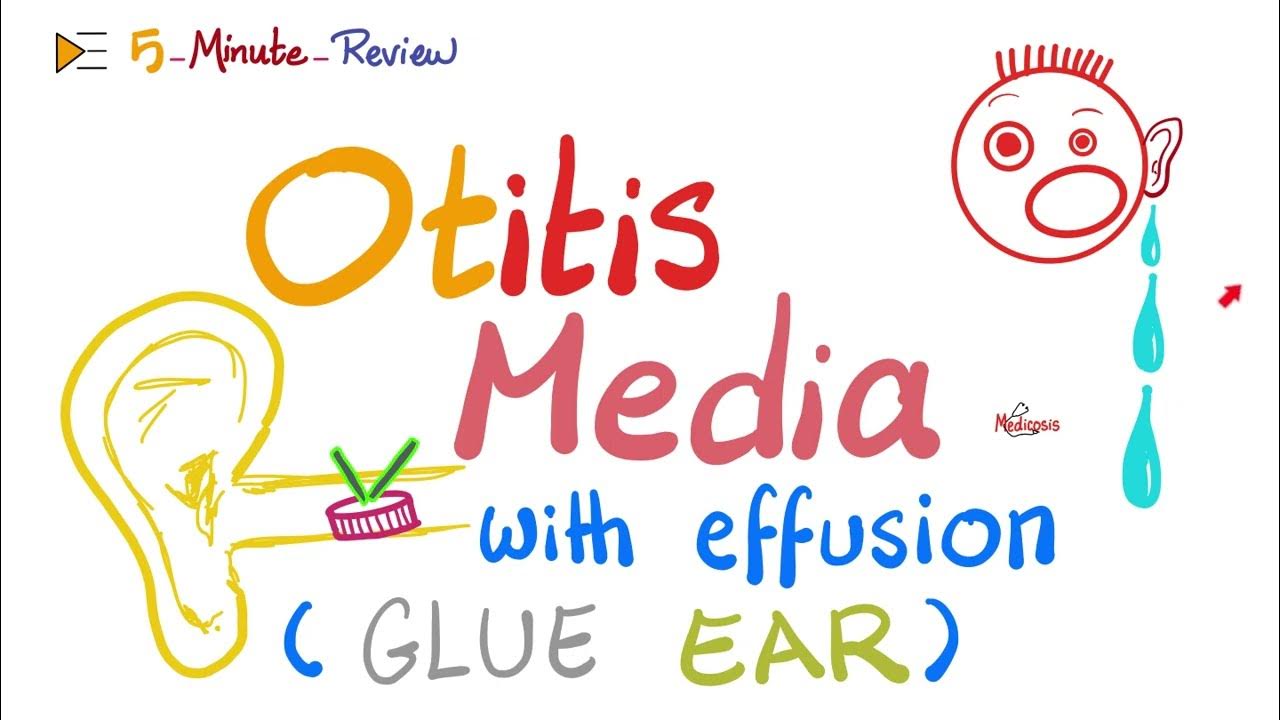 Otitis Media With Effusions Glue Ear Youtube