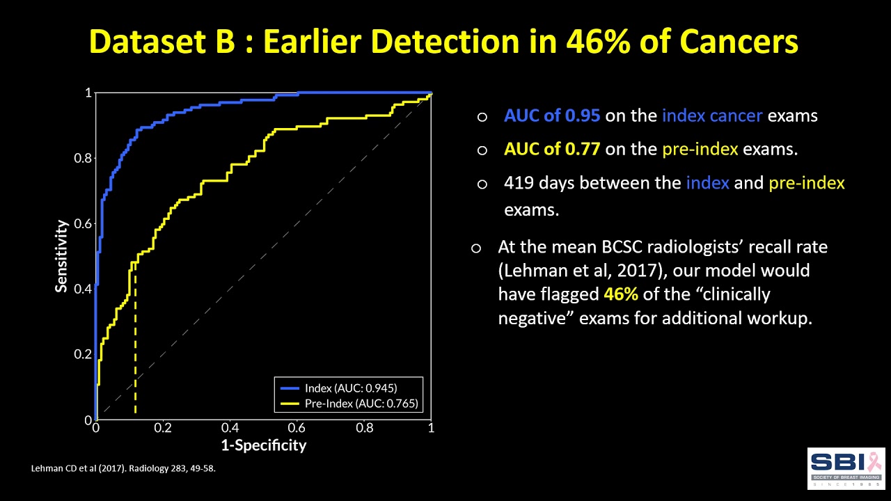 Machine Learning Model Identifies Malignancies Earlier in Screening Mammograms