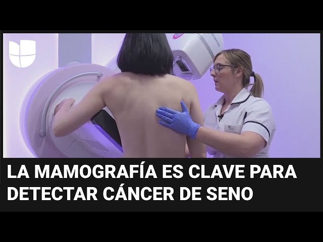 ¿Desde qué edad se deben realizar las mamografías? Esto dicen los expertos