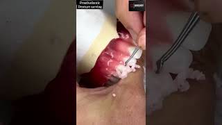 Denture Carving | Complete Denture Carving 💯  #shorts #dentist  #viral 🔥🔥