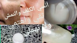 وصفه فعاله لمعالجه الكلف و النمش بمكونات طبيعيه تغذي البشره من العمق وتجعلها صافيه . 