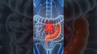 Appendix के समस्या का संकेत जाने ! #appendicitis
