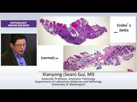 New Concepts in IBD Pathology
