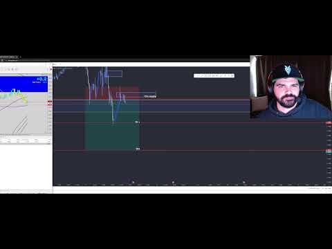 🔴 LIVE DAY TRADING – Scalping Strategy | FOREX