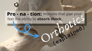 Custom Foot Orthotics: Overpronation and Arch Support In Plain English