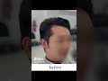 Kanagawa,Yokohama Men's Beauty Salon【For those concerned about side bulges】Japan #Shorts