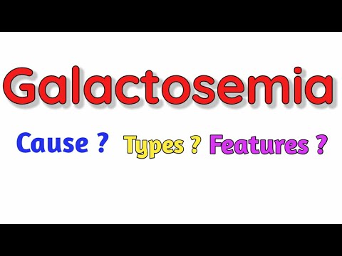 Galactosemia || Casue || Types || Features || Diagnosis ||Treatment