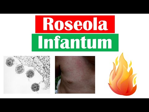 Video: Roseola huambukiza kwenye nyuso kwa muda gani?