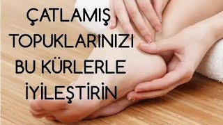ÇATLAMIŞ TOPUKLARINIZI BU KÜRLERLE İYİLEŞTİRİN screenshot 3