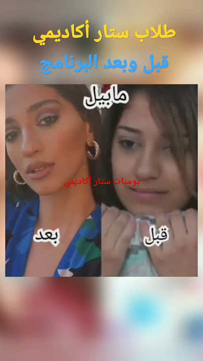 طلاب ستار أكاديمي قبل وبعد البرنامج