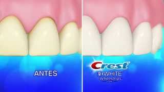 Shakira - Crest 3D White/ Oral-B (2014)