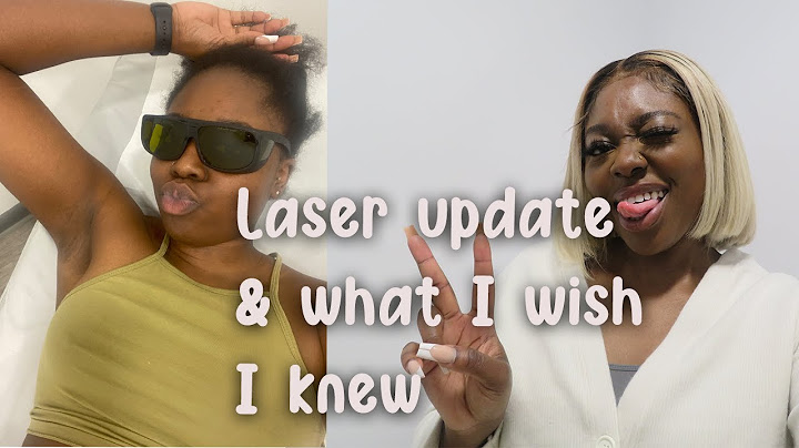 Laser stretch mark removal before and after african american