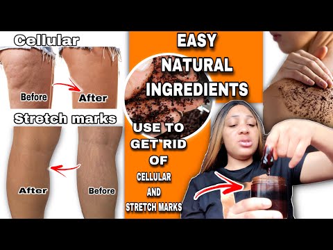 HOW TO MAKE COFFEE SCRUB TO GET RID OF CELLULITE, STRAWBERRY LEGS & STRETCH MARKS NATURALLY AT HOME