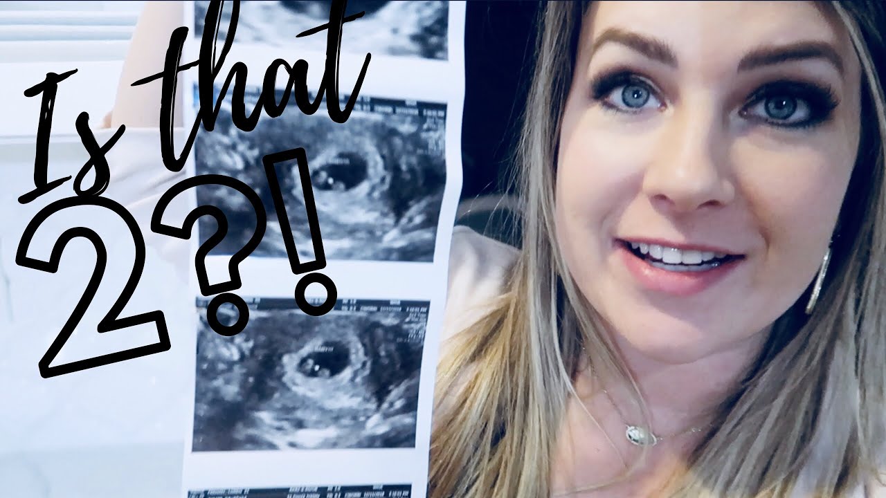 no heartbeat at 7 weeks positive stories no heartbeat at 7 weeks positive stories