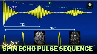 Spin Echo Pulse Sequence In Mri Mri Hindi All About Radio