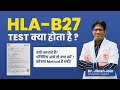 Hlab27 test    back pain test  positive      dr jitesh jain