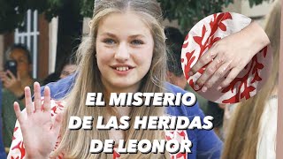 EL MISTERIO DE LAS HERIDAS DE LA PRINCESA LEONOR EN LAS MANOS