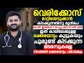 കാലുകളിൽ വെരികോസ് വെയ്ൻ വരുന്നതിന്റെ കാരണം ഇതാണ് ? ഇതിന്റെ പരിഹാരം കണ്ടുനോക്കു |