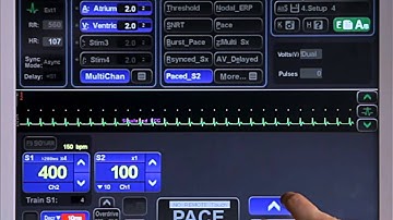 5B - Advanced Pacing - Advanced Protocols