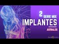 Implantes Astrales Video 2《