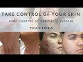 Fractora Skin Rejuvenation