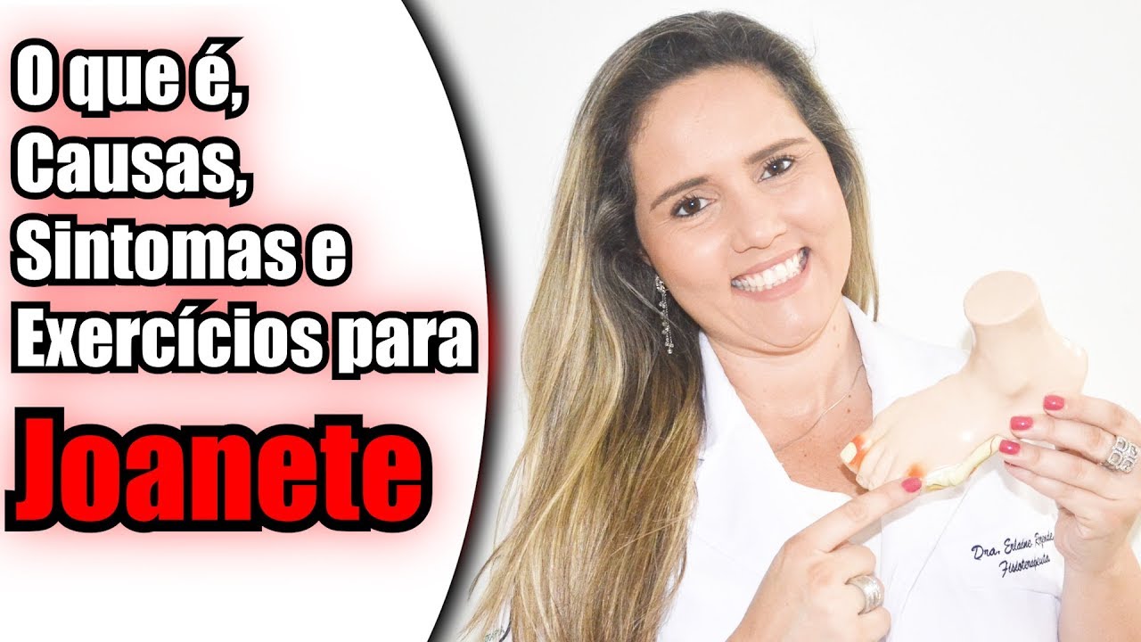 Joanete - Saiba o que é, As Causas, Os Sintomas e Os Tratamentos!
