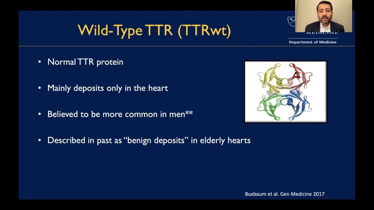 Cardiac Amyloidosis: Update on Diagnosis and Treatment