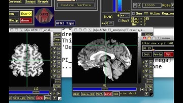 Functional Connectivity in AFNI, Step 3: Creating Connectivity Maps