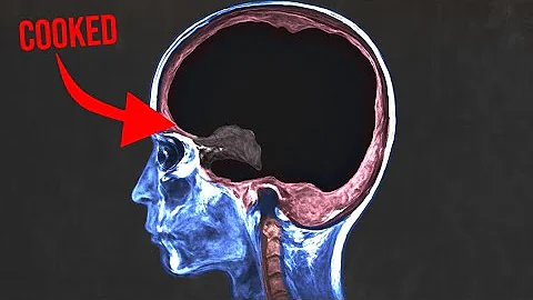 A man asked AI for health advice and it cooked every brain cell