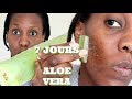 LES EFFETS DE L' ALOE VERA SUR MA PEAU PENDANT 7 J !!