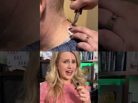 Doctor reacts to a shocking removal