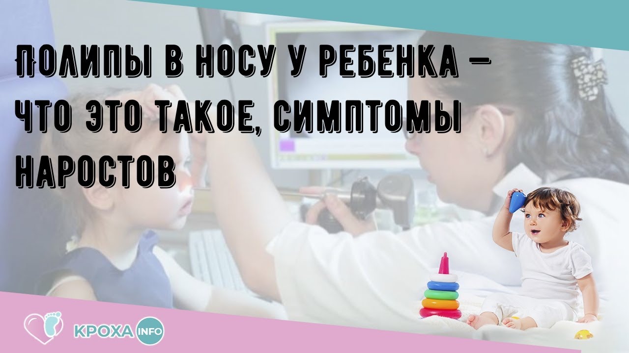 Полипы в носу у ребенка — что это такое, симптомы наростов - YouTube