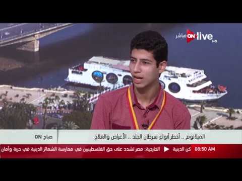 صباح  مشروع البحث العلمي ل أحمد مطر الحاصل على المركز الأول في معرض جنيف للإبتكارات