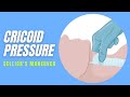 Cricoid pressure | Technique