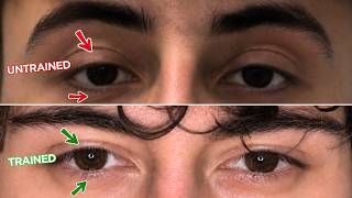 Your eye area isn’t a genetic problem its just untrained