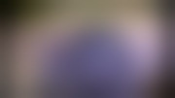 Uveitic eye with a dense white cataract, small pupil, and fibrotic membrane