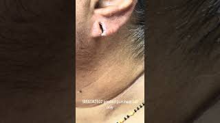 Earlobe repair|| #sejalparlour#earlobe#repair#earrape#earearloberepairi#youtubevideo#skincare#shorts