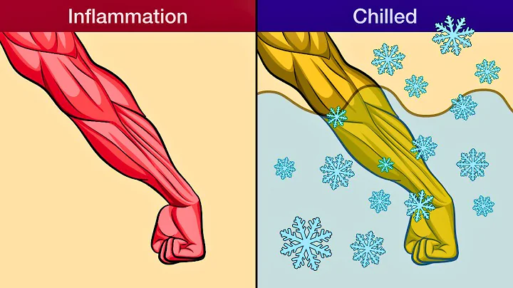 Why athletes are obsessed with ice plunging?