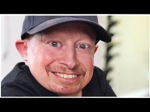 Verne Troyer Muere Mini Yo En La Saga Austin Powers En 49