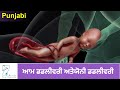 प्रसव प्रक्रिया और उसके चरण