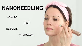 Nano Needling | Everything You Need to Know | +Giveaway