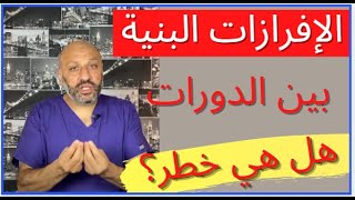 الحلقة (٣٨ ) أسباب نزول  إفرازات بنية بين الدورات