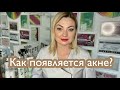 Смотреть всем кто НЕ хочет акне! #acne #угри