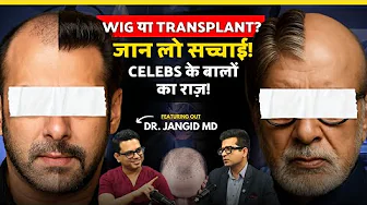 Hair Transplant की पूरी सच्चाई | Celebs, Myths, Cost, Risks & Reality | Hair Transplant Surgeon