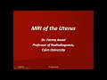 13 female pelvis 1  uterus  prof dr  fatma awad