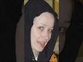 Iggy Azalea Before Full Body Surgery Shocking Iggyazalea Playboicarti Travisscott Kyliejenner 