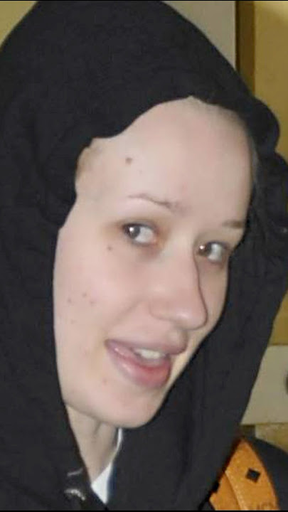 Iggy Azalea before full body surgery #shocking #iggyazalea #playboicarti #travisscott #kyliejenner