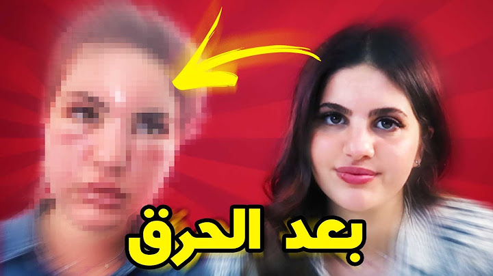 سبب اختفائي عن اليوتيوب و السوشال ميديا (نحرقت)