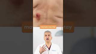 Infections Don't Heal #infection #infectionprevention #spinesurgery #spinespecialist #spinehealth